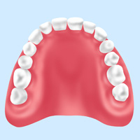 レジン床義歯（総入れ歯・部分入れ歯）